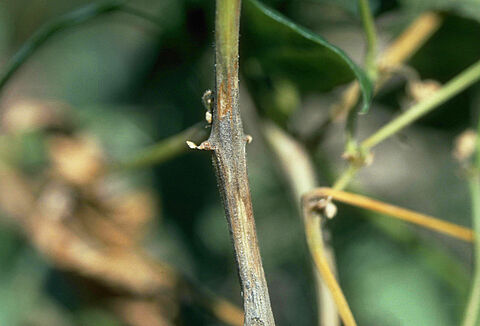 Ανθρακώδης σήψη